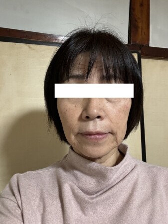 美顔・美肌でさらに輝く☆アンチエイジング＆骨格矯正ヒーリングのK.N様の写真